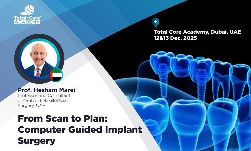 From Scan to Plan: Computer Guided Implant Surgery